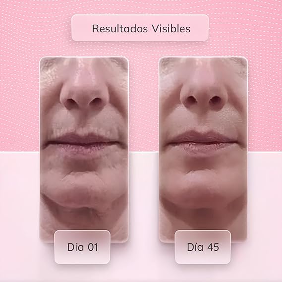 MASAJEADOR ESTIRAMIENTO FACIAL