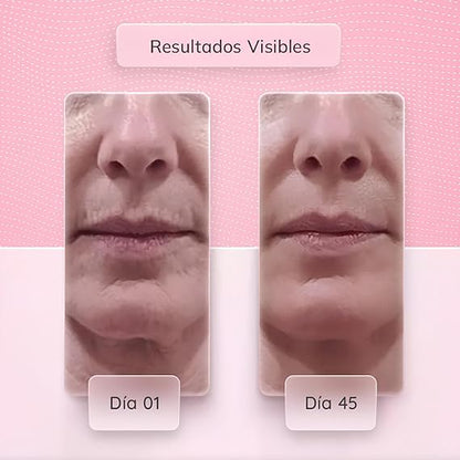 MASAJEADOR ESTIRAMIENTO FACIAL